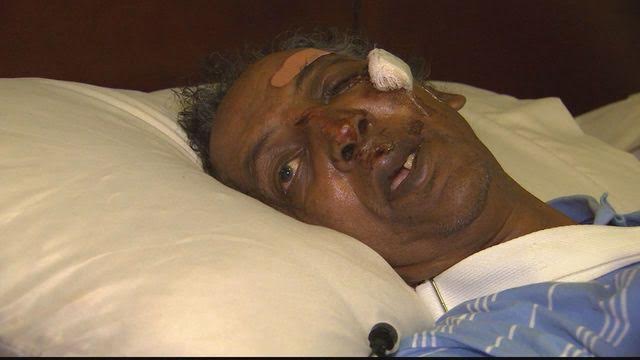60-Year-Old Northwest Taxi Driver Attacked in Latest Driver Violence Incident